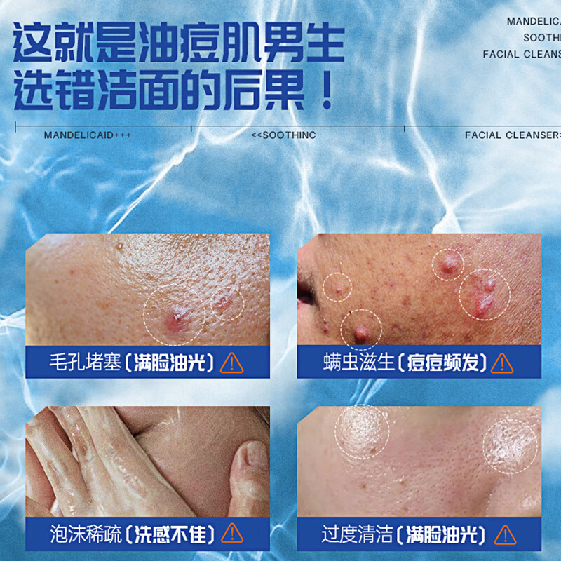 韩方五谷杏仁酸洗面奶氨基酸保湿祛痘洁面乳清洁控油净淡痘男女士洗面奶 【1瓶抵2瓶】大容量 300g