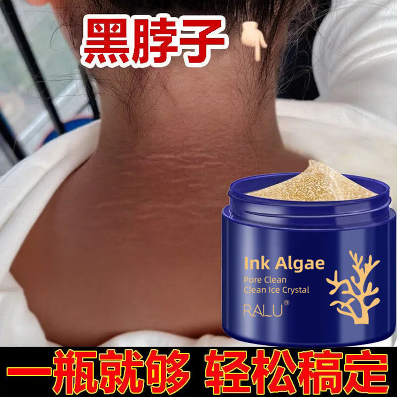 时溪黑棘皮病f治去脖子黑色素去除苗药膏大腿内侧臀部手臂关节 1盒