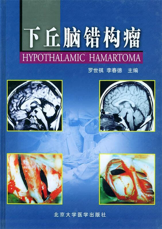 下丘脑错构瘤 9787810715997 罗世祺,李春德 主编 北京大学医学出版