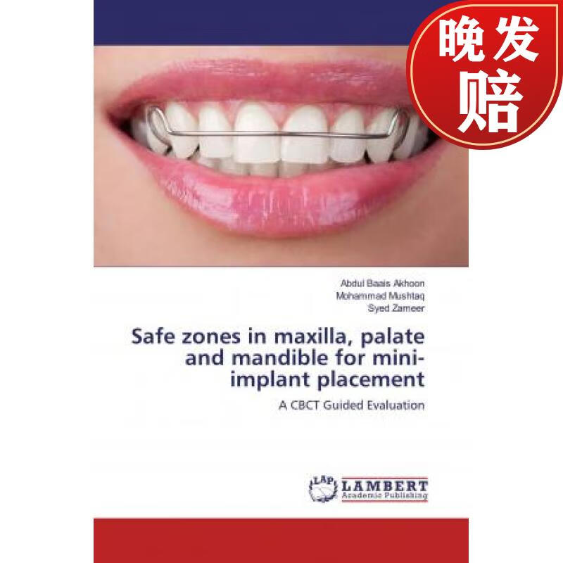 【4周达】safe zones in maxilla, palate and mandible for mini