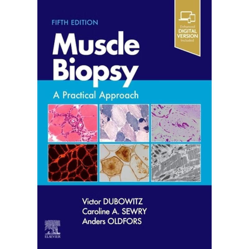 预定muscle biopsy肌肉活检