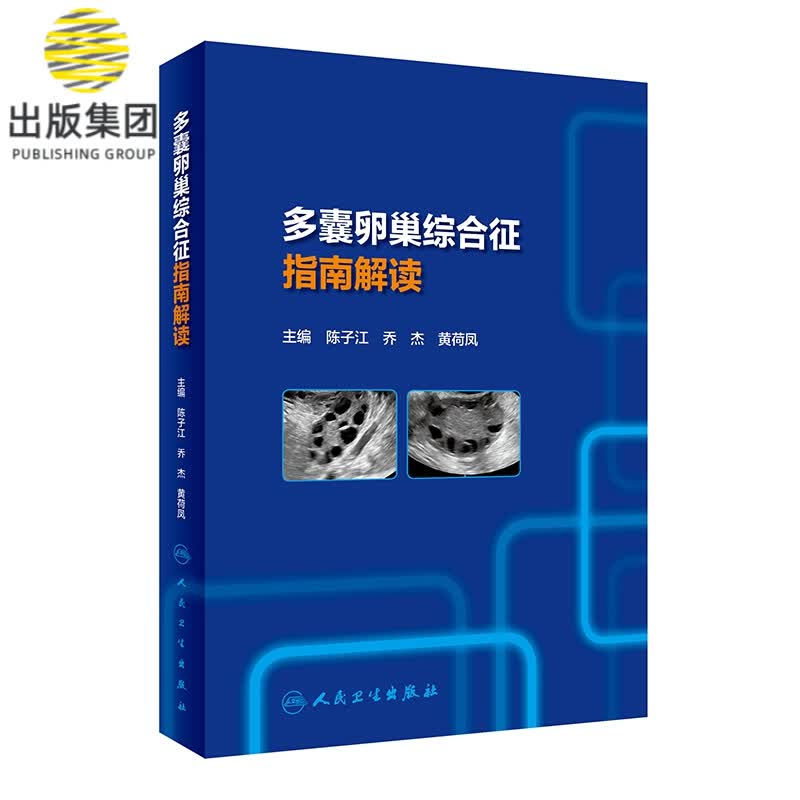 多囊卵巢综合征指南解读