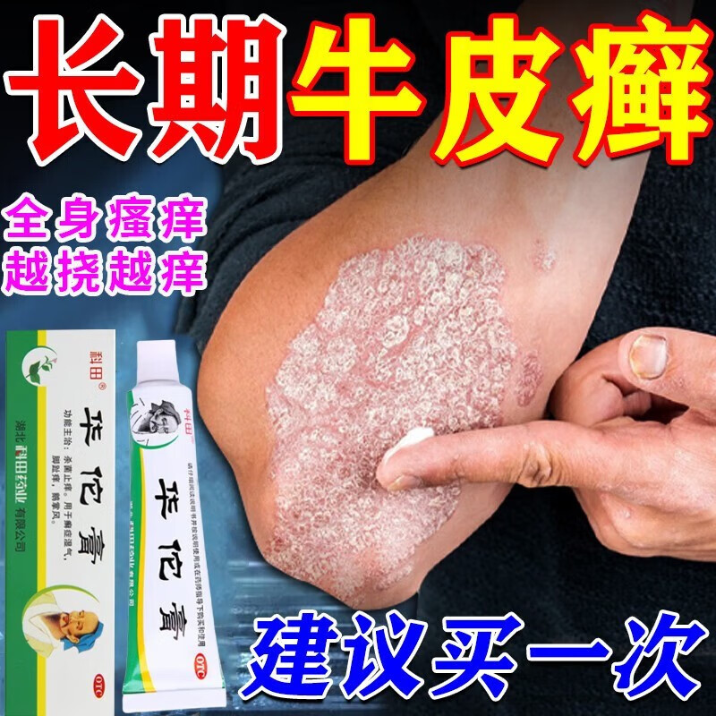 【牛皮癣专用药膏】顽固银屑病大腿内侧股癣手足癣鹅掌风皮炎湿疹皮癣