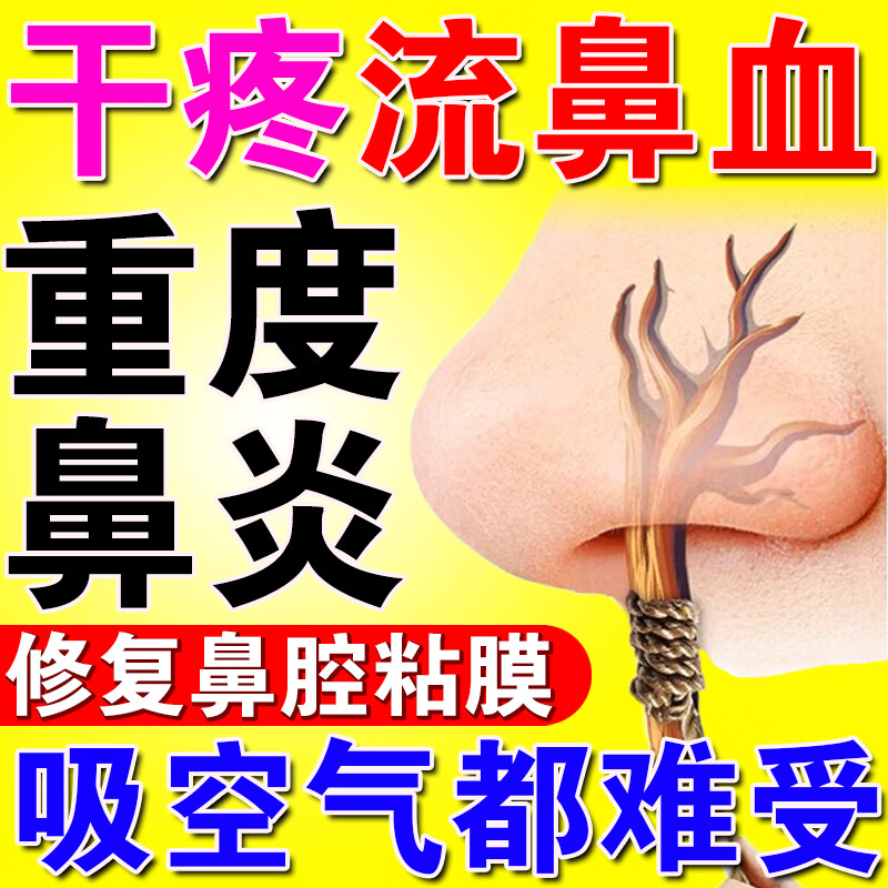 流鼻血鼻腔干燥出血结痂修复鼻黏膜湿润保湿喷雾剂鼻子干痒慢性鼻炎