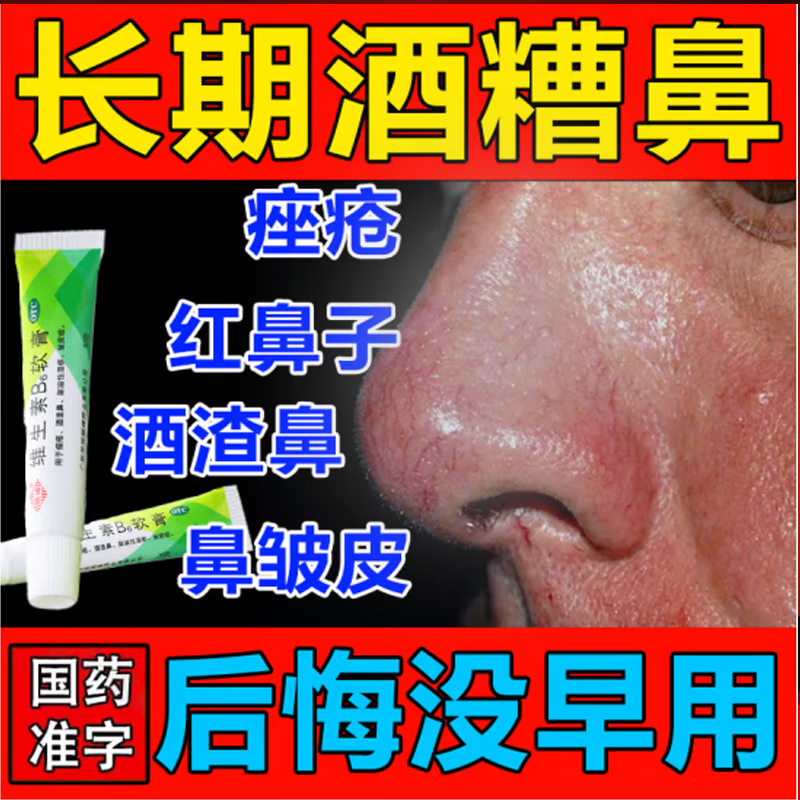 治酒糟鼻药膏】草莓鼻酒糟鼻红鼻酒渣鼻鼻头除螨虫 黑头粉刺草莓鼻去