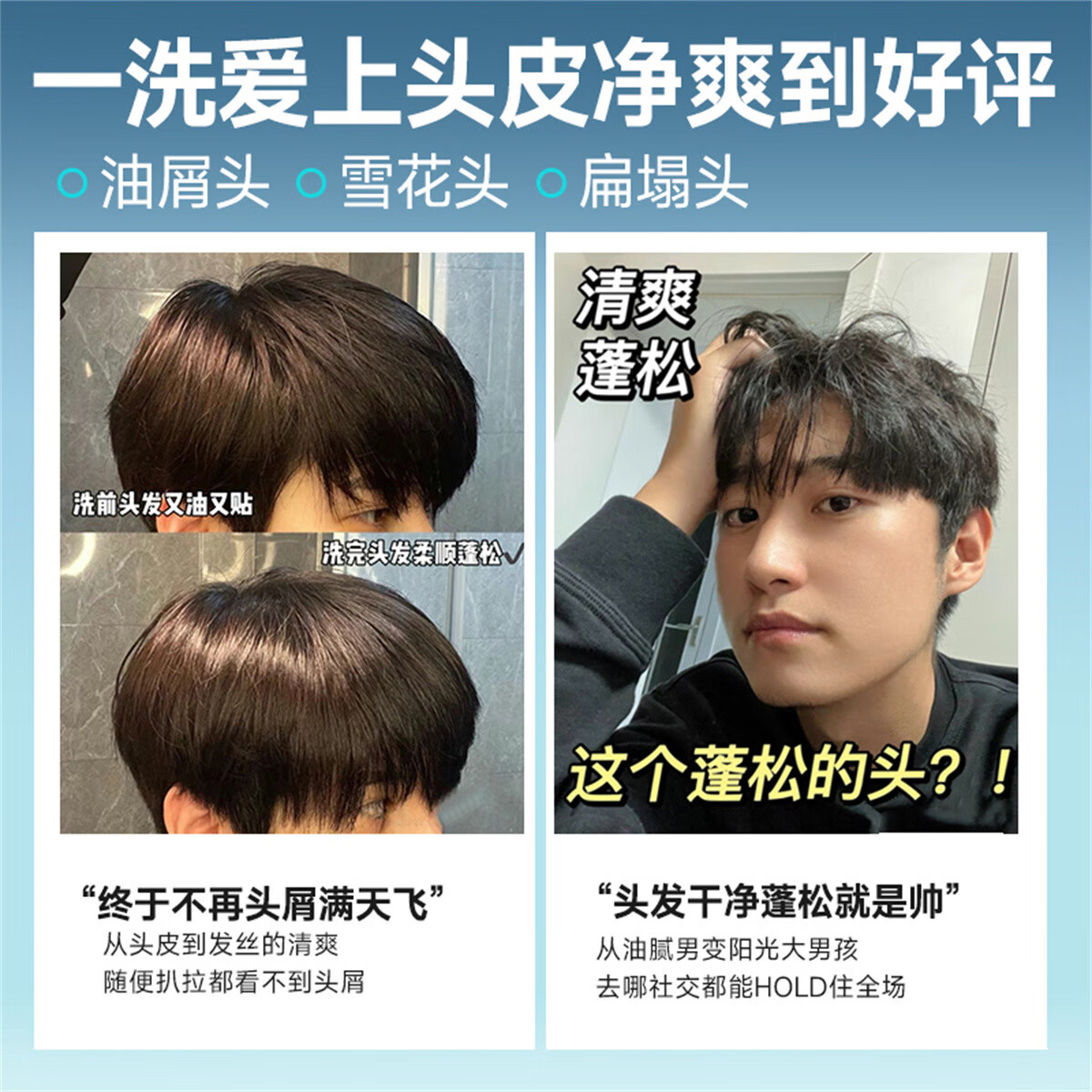 左颜右色二硫化晒洗发水男士控油去屑止痒蓬松洗头滋润护发抑菌沐浴露套装 二硫化硒洗发水500g