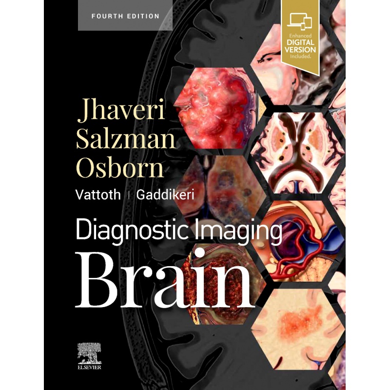 预订Diagnostic Imaging: Brain 诊断成像：大脑