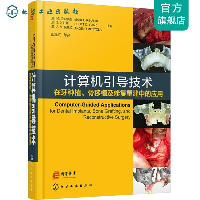 计算机引导技术在牙种植、骨移植及修复重建中的应用