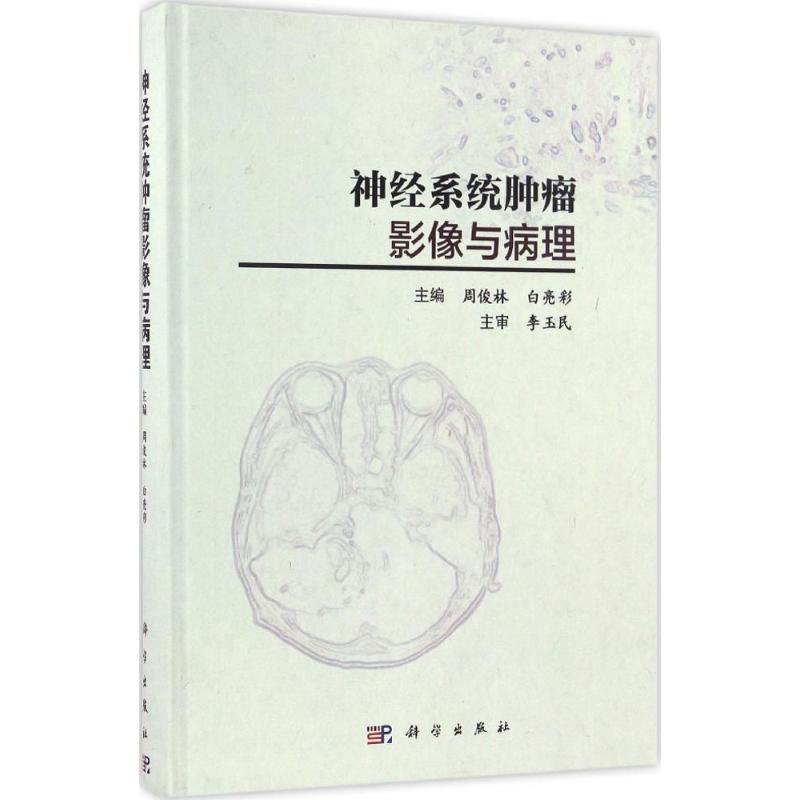 神经系统肿瘤影像与病理