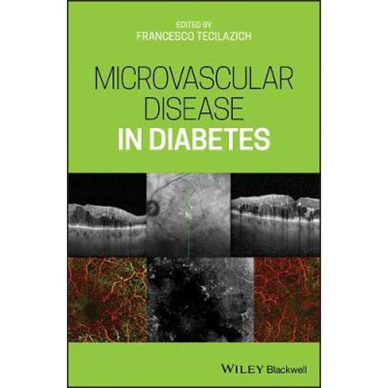 预订microvascular disease in diabetes
