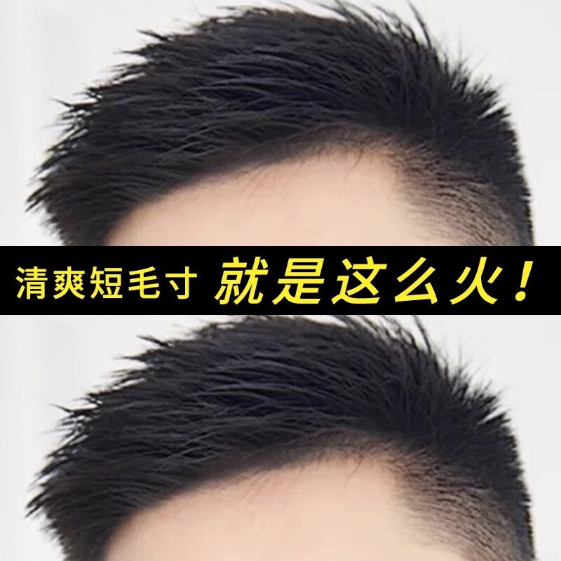 佳丽仟丝假发男短发真发无痕隐形帅气毛寸全真发丝男士假发片补头顶补发男 时尚毛寸款【递针顶心16*18】 自然黑怎么看?