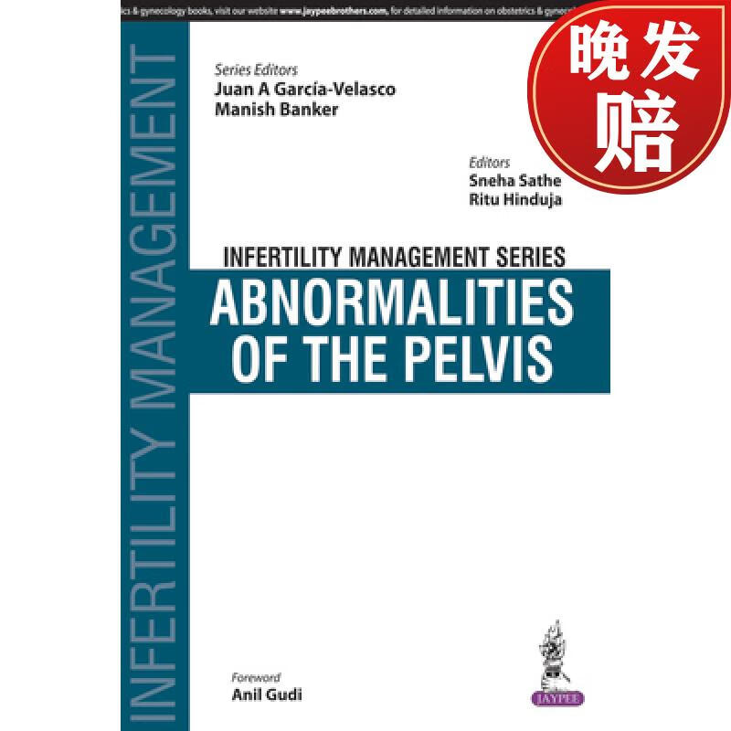 【4周达】infertility management series: abnormalities of the