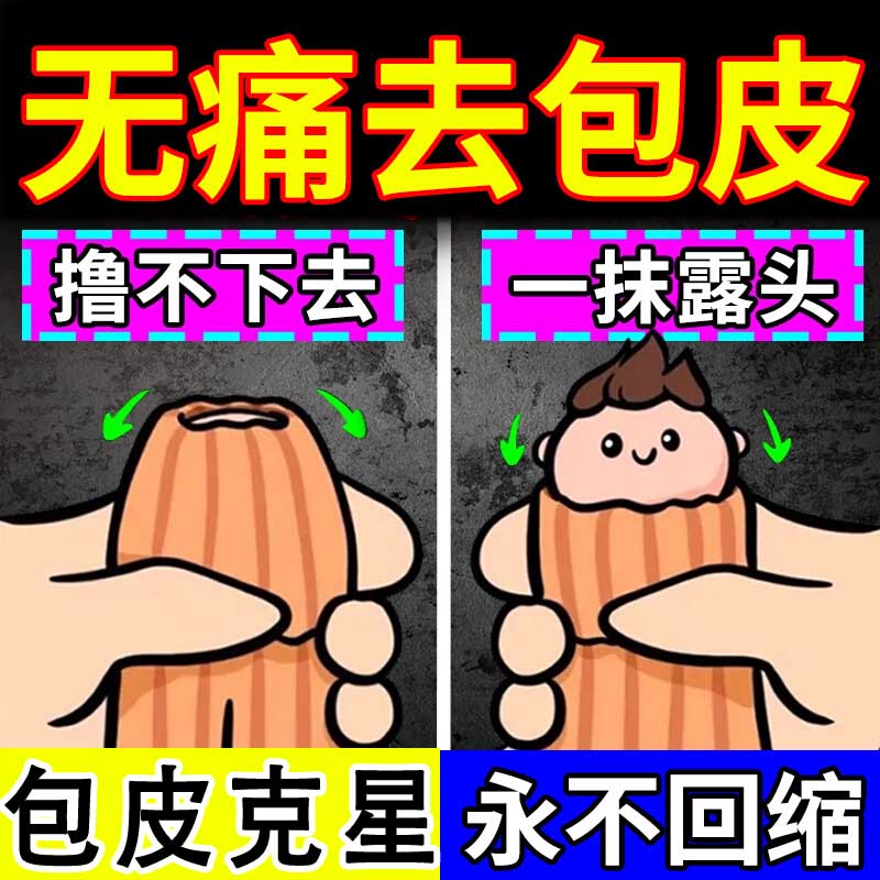 去包皮】包皮阻復(fù)環(huán)按摩器陰莖鍛煉龜頭敏感訓(xùn)練器陰徑環(huán)套男士入珠套環(huán)包皮固定器成人男性用品性工具大全 全家桶五只裝-包皮阻復(fù)環(huán)長期佩戴隱形環(huán)切器 包皮過長矯正神i器