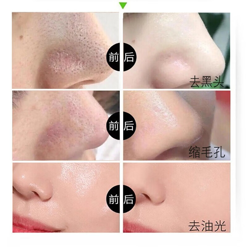 九叶草竹炭撕拉面膜男女士黑头粉刺黑鼻头撕拉式清洁收缩毛孔紧致肌肤 1瓶装【撕出健康肌肤】