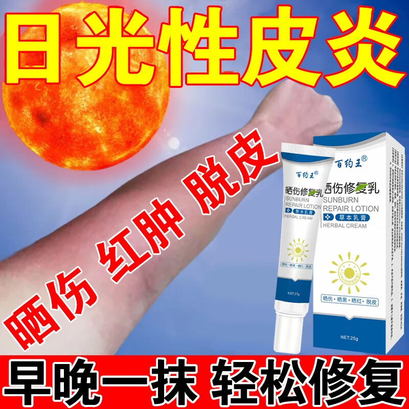 晒伤修复药i膏日光性皮炎紫外线过敏药抹膏晒伤脱皮止瘙痒防晒膏 单盒