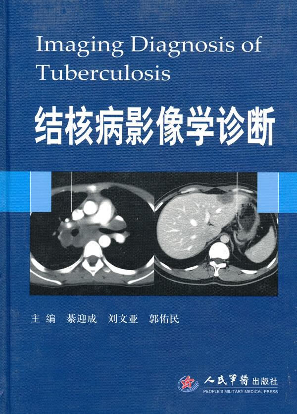 结核病影像学诊断