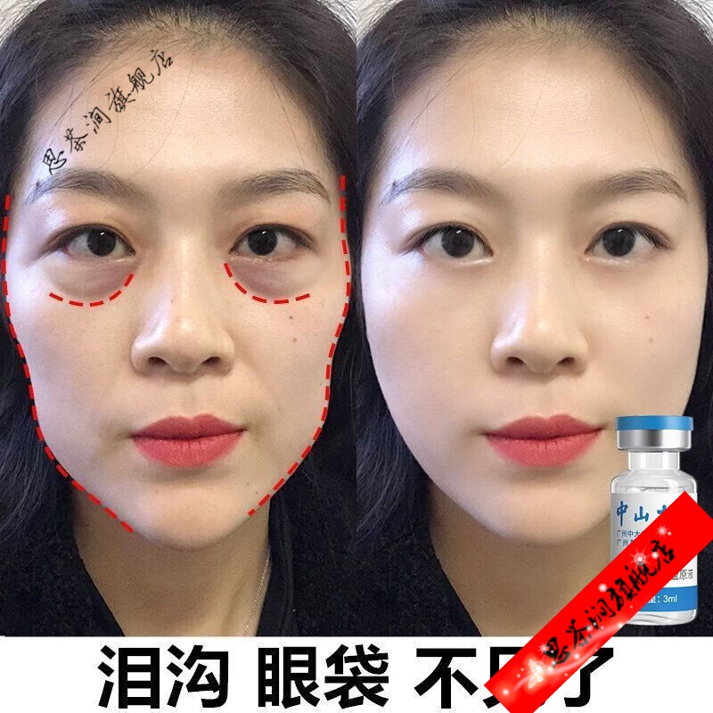 豹纹妈妈眼袋修复套装泪沟眼袋丰泪沟填充眼窝凹陷饱满卧蚕修复黑眼圈
