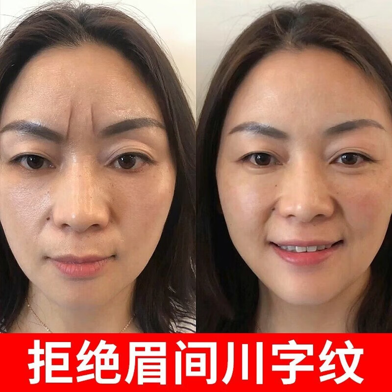 韓倫美羽水滴川字紋貼 膜淡化額頭抬頭紋提拉緊致抬頭紋法令紋保 2盒90用戶(hù)的選擇(48片)