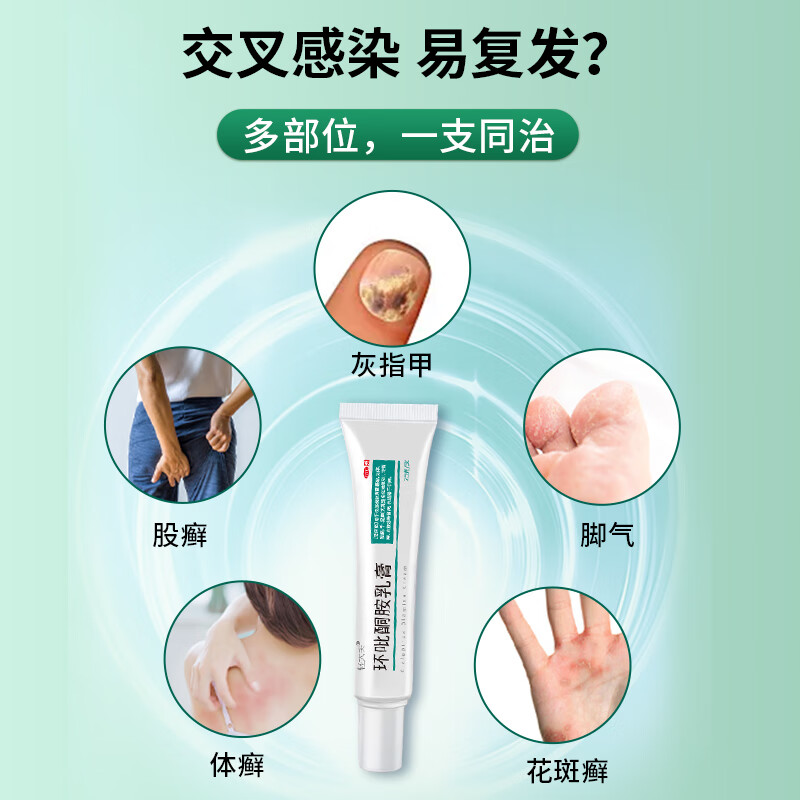 轻大夫环吡酮胺乳膏25g治疗灰指甲药甲癣药体癣治疗药膏脱甲真菌感染脚臭体癣股癣汗斑癣脚治疗脚气 3盒装