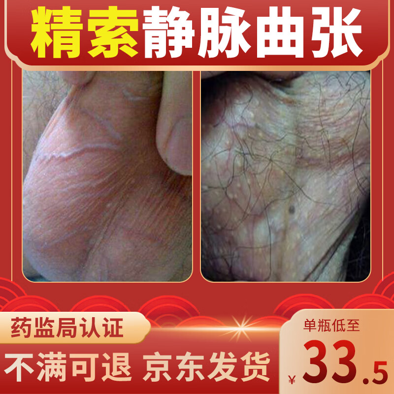 精索静脉曲张痛外用睾丸疼痛 冷敷凝胶精索炎痛腹股沟痛消痛冷敷