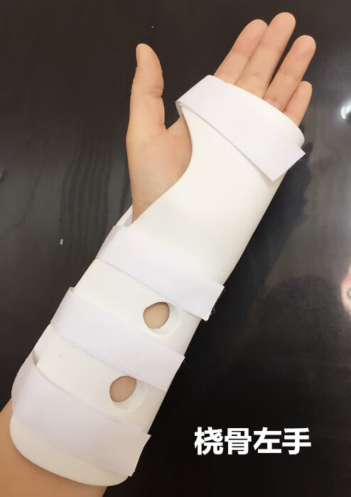 百德莱高分子挠骨骨折夹板手腕扭伤固定支具骨裂护腕后石膏前臂三角