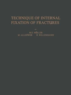 【预订】technique of internal fixation of