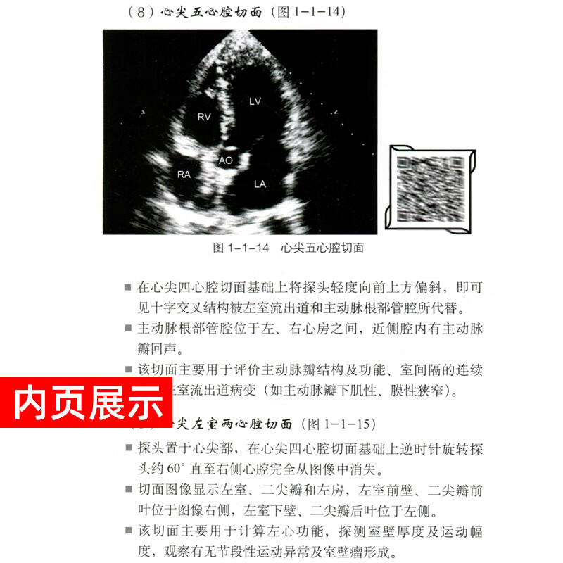 第二版 心脏大血管系统疾病超声心动图鉴别诊断要点心内科临床医师