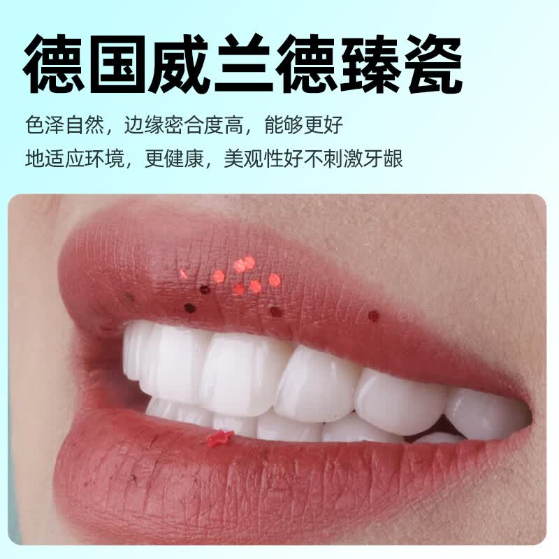 仿真全瓷牙贴面 牙齿贴片美白贴片全瓷牙贴片氟斑牙黄去牙齿全瓷贴面