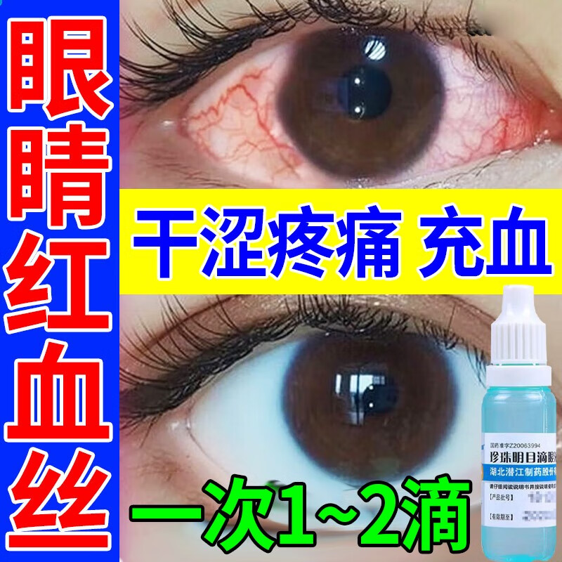 去眼睛红血丝眼药水眼睛干涩充血长时间用眼疲劳结膜充血红血丝修复