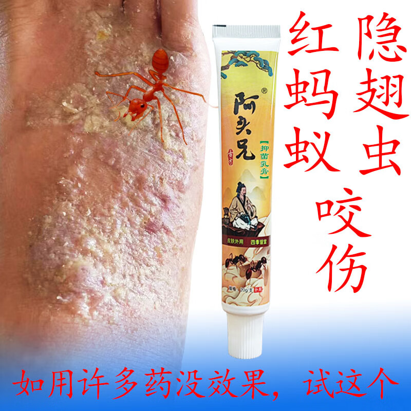 红蚂蚁咬伤膏阿头兄红火蚁咬伤乳膏隐翅虫蜘蛛马蜂跳蚤蚊虫叮咬皮 咬