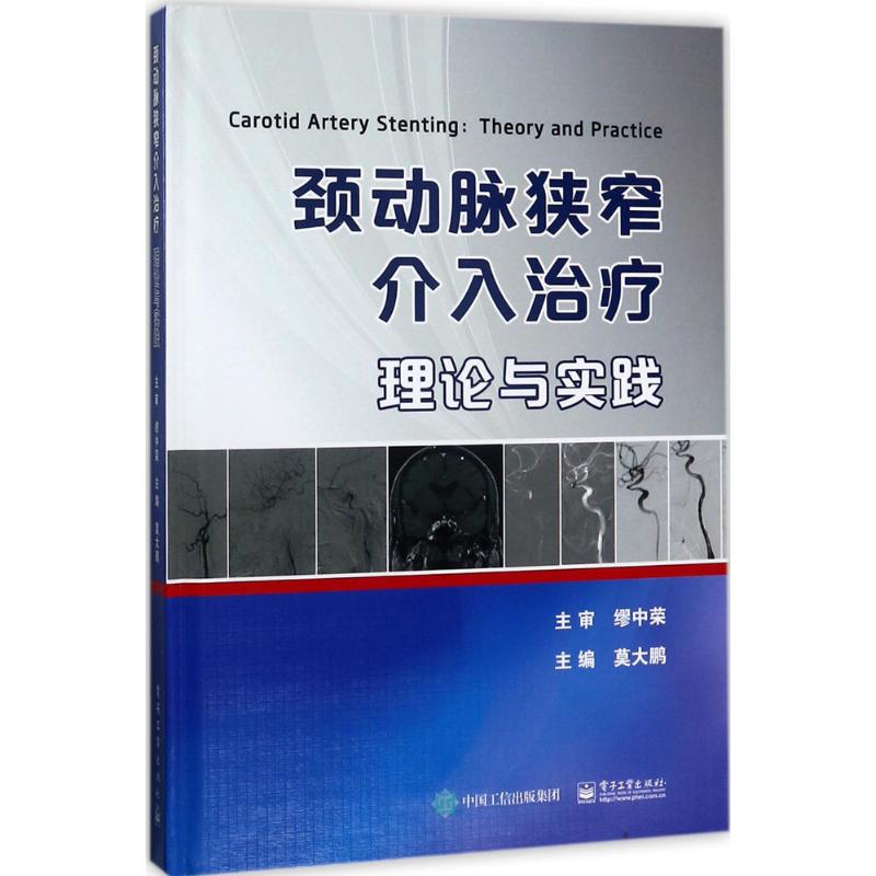颈动脉狭窄介入治疗