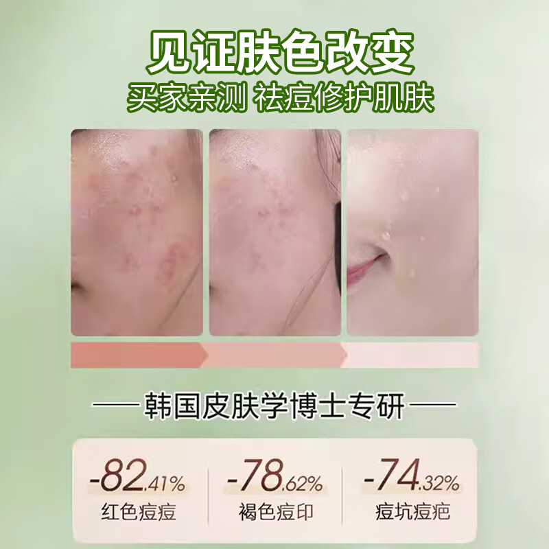 雪柔雅小绿瓶净肤祛痘精华液淡印祛痘精华闭口粉刺保湿黑白头痘坑可用 祛痘精华液*2瓶