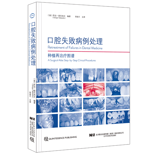 口腔失败病例处理