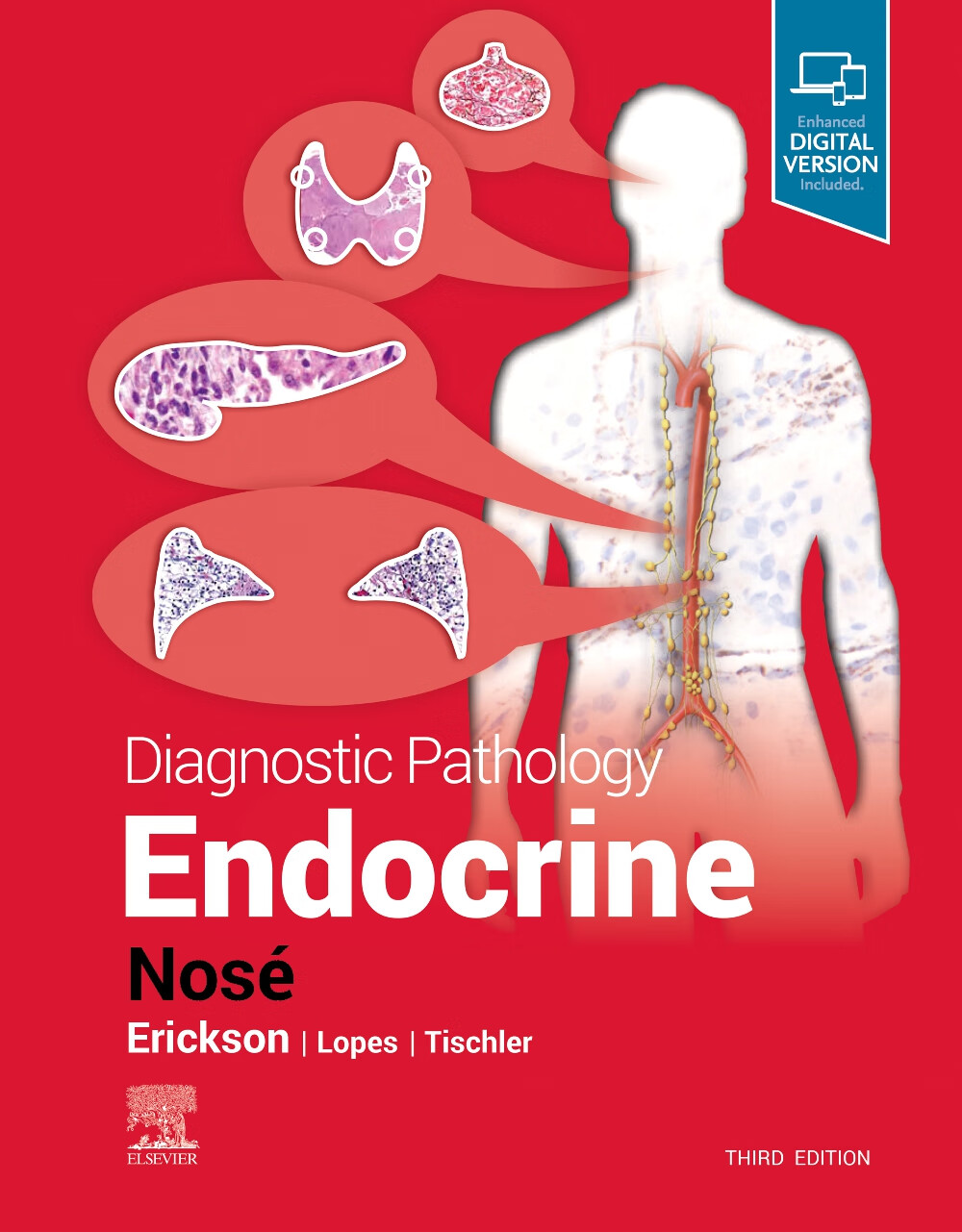 diagnostic pathology: endocrine 诊断病理:内分泌 病理生理学 英文