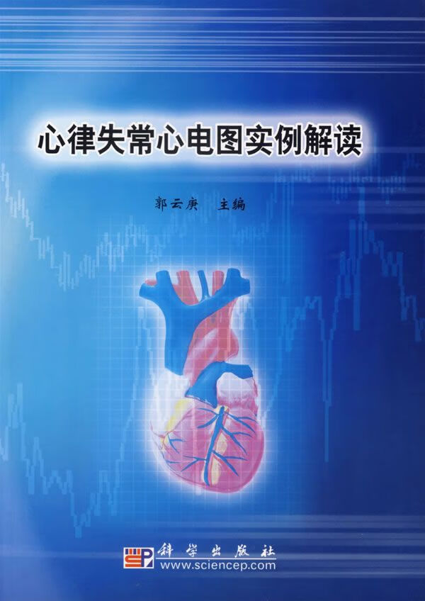 心律失常心电图实例解读