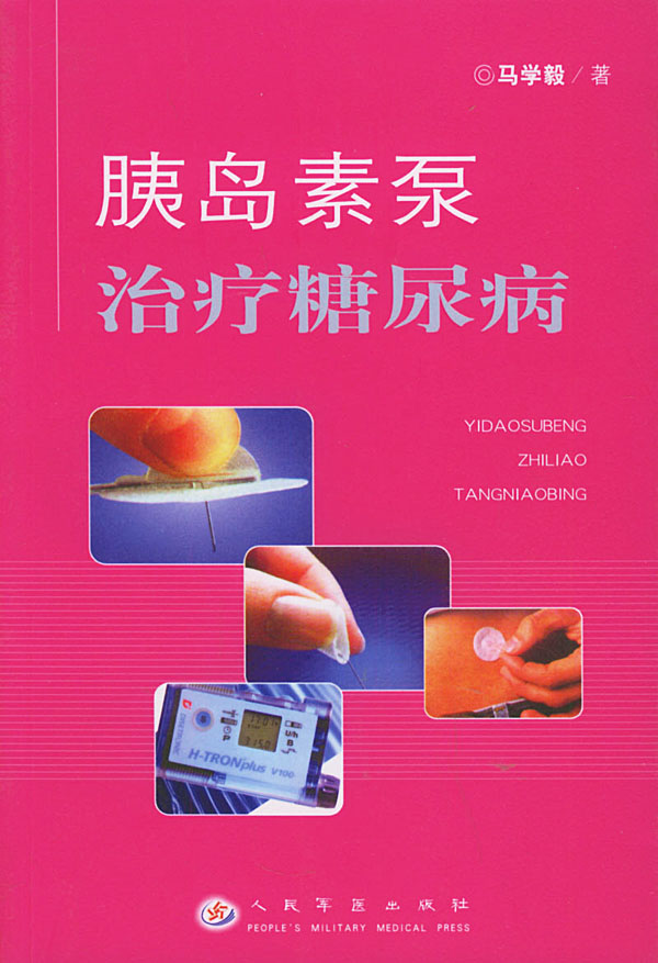 胰岛素泵治疗糖尿病