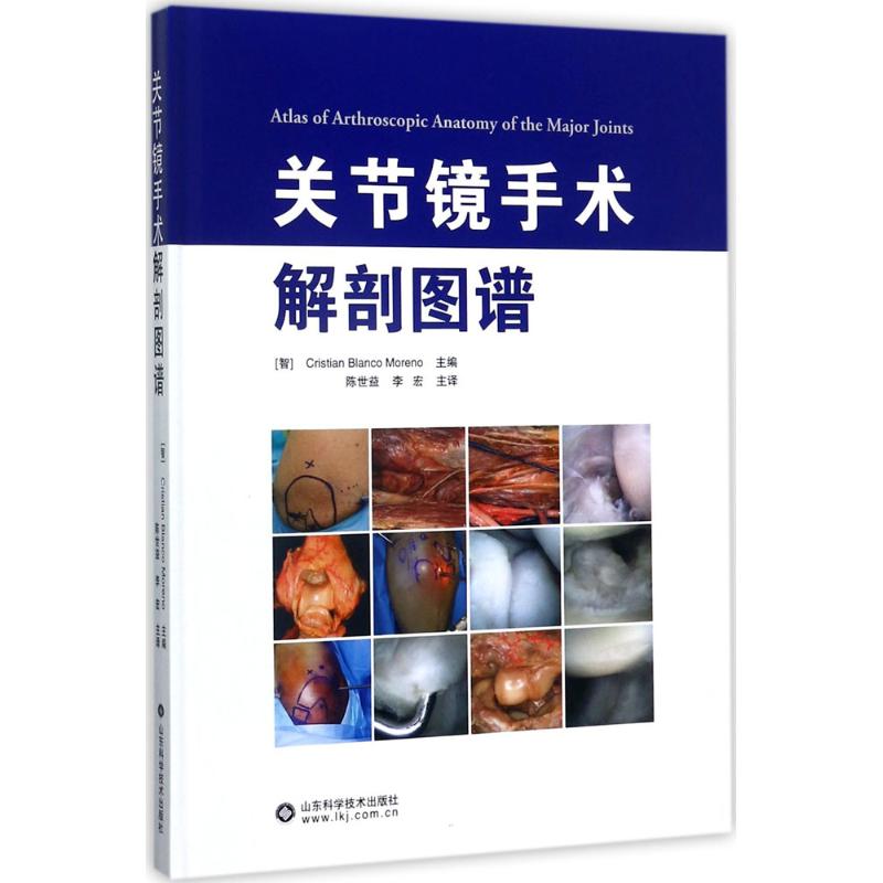 关节镜手术解剖图谱 