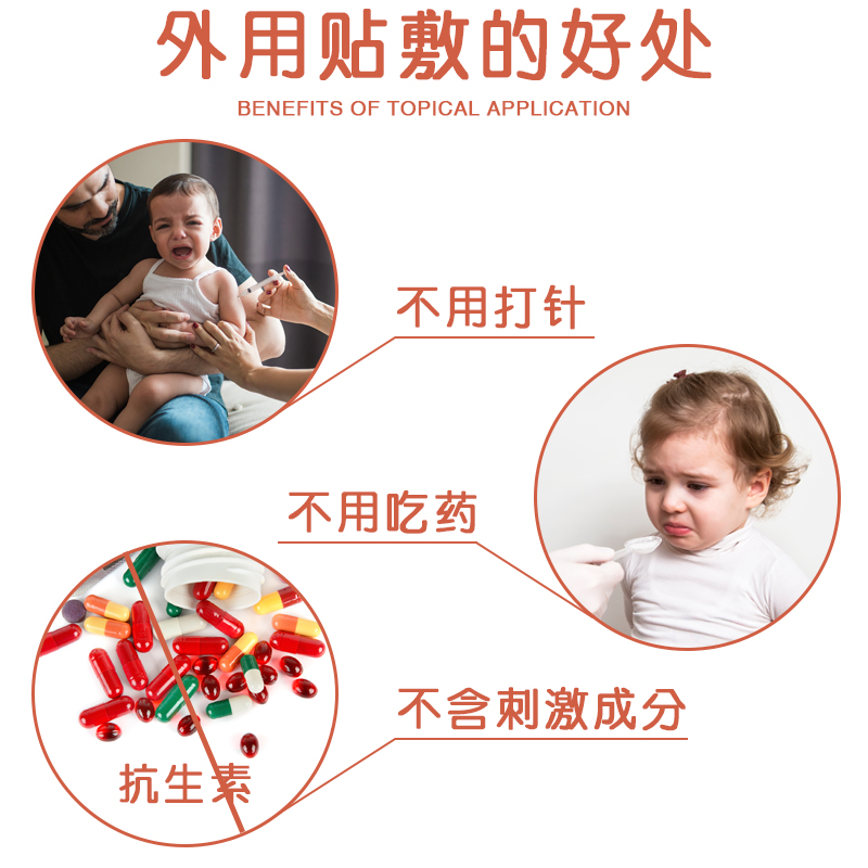 景天堂 咽扁贴儿童腺样体肥大小儿扁桃体发炎喉咙痒肿痛穴位贴 5盒【实惠装】