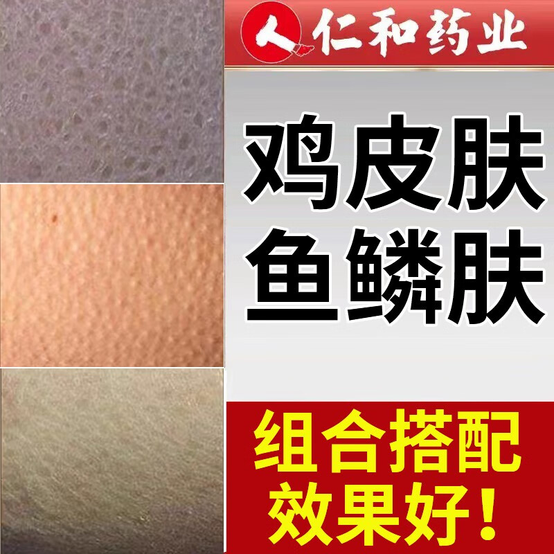 磨砂膏去鸡皮肤毛囊角质疙瘩大腿手臂身体去除膏角化浴盐鱼鳞霜症 盐