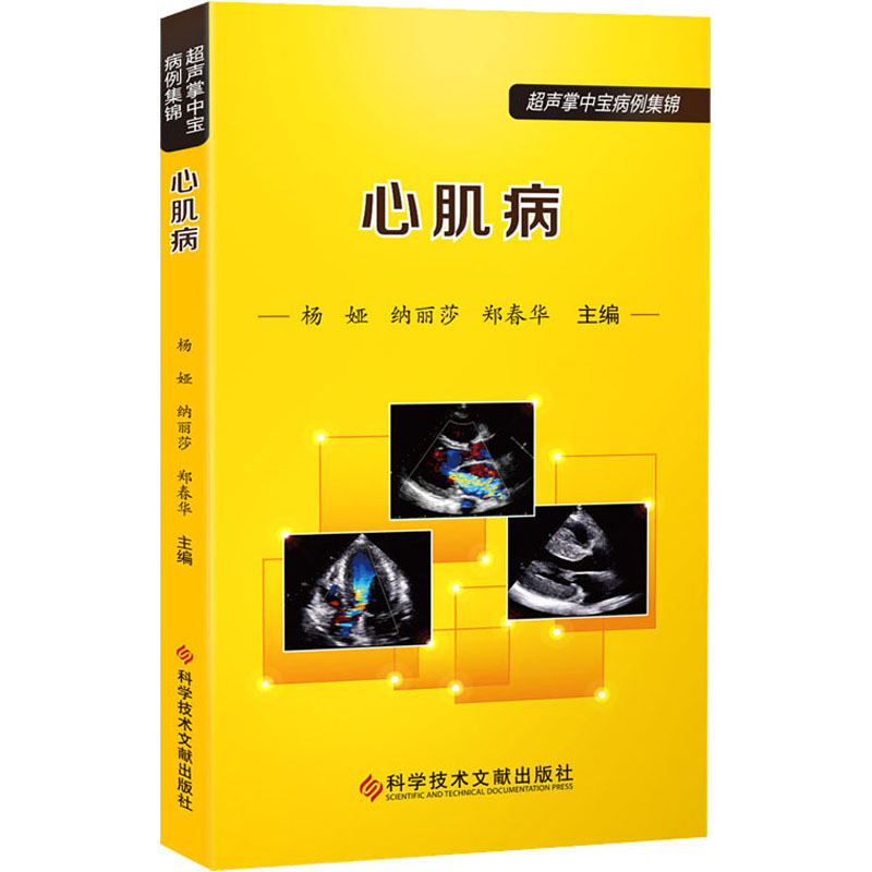 心肌病