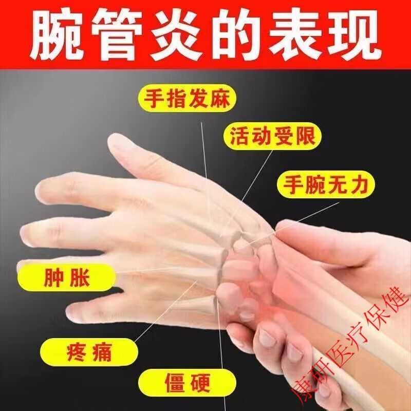 腕管综合症活络油护腕专用膏贴睡觉手指麻木手碗神经肿胀酸痛关节疼痛