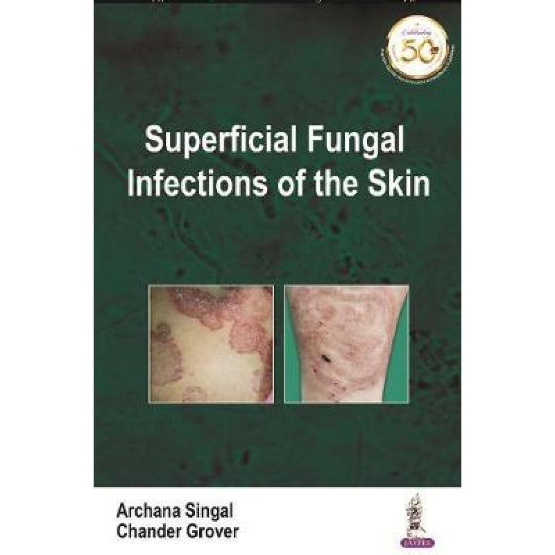 superfucial, 预订 superficial fungal infections of the skin