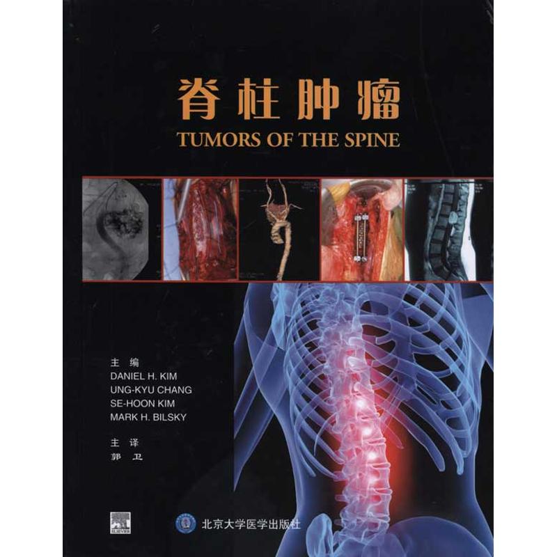 脊柱肿瘤