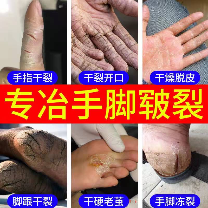 凡士林特润倍护霜手足防裂特护皲裂膏防冻护手霜防干裂冻伤疮膏皮肤防