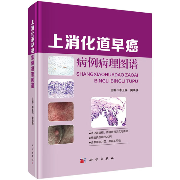 上消化道早癌病例病理图谱 李玉民,黄晓俊