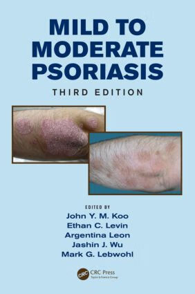 预订 mild to moderate psoriasis, third edition