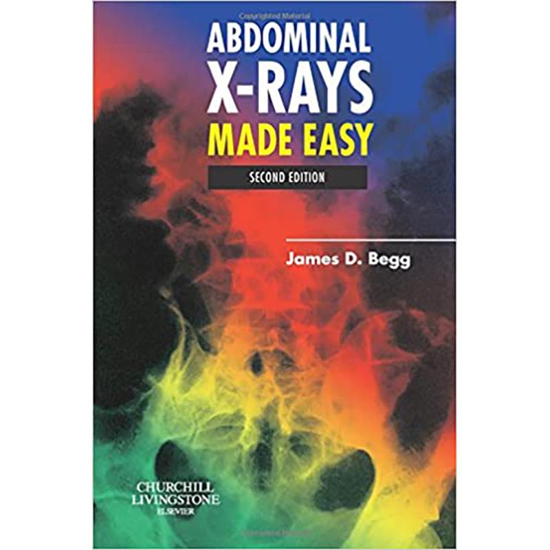 预订abdominal x-rays made easy