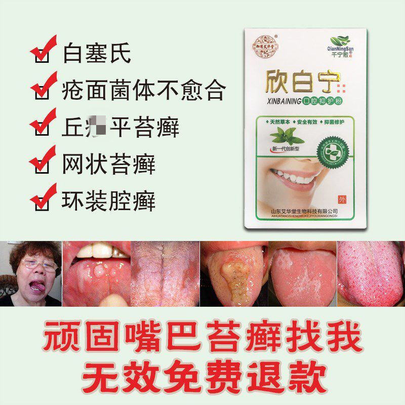 千宁散欣白宁口腔扁平苔藓网状白纹斑舌炎地图舌上火