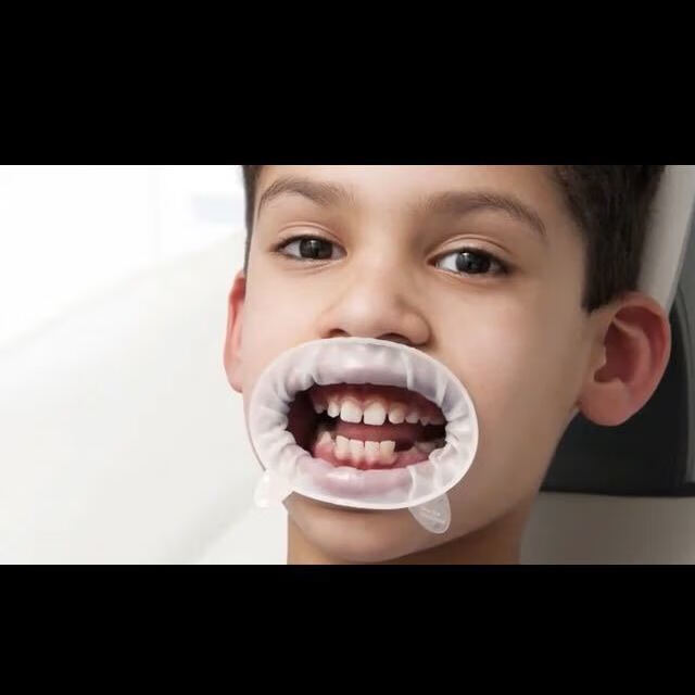 牙科橡皮障开口器 义获嘉三维立体o型开口器医用蓝白色橡胶开口 美牙