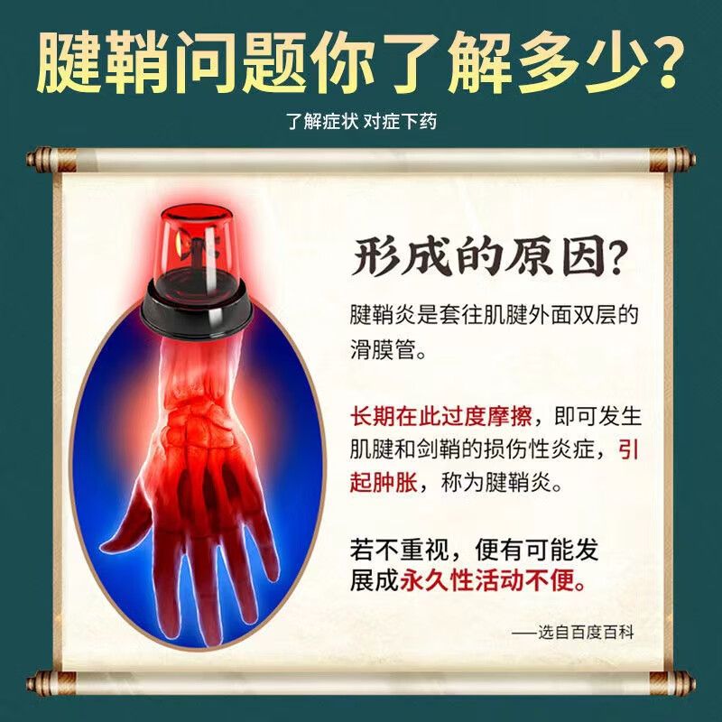 腱鞘膏大拇指按摩膏手腕护腕膏贴网球鼠标手艾草膝盖贴颈椎活络膏 1瓶